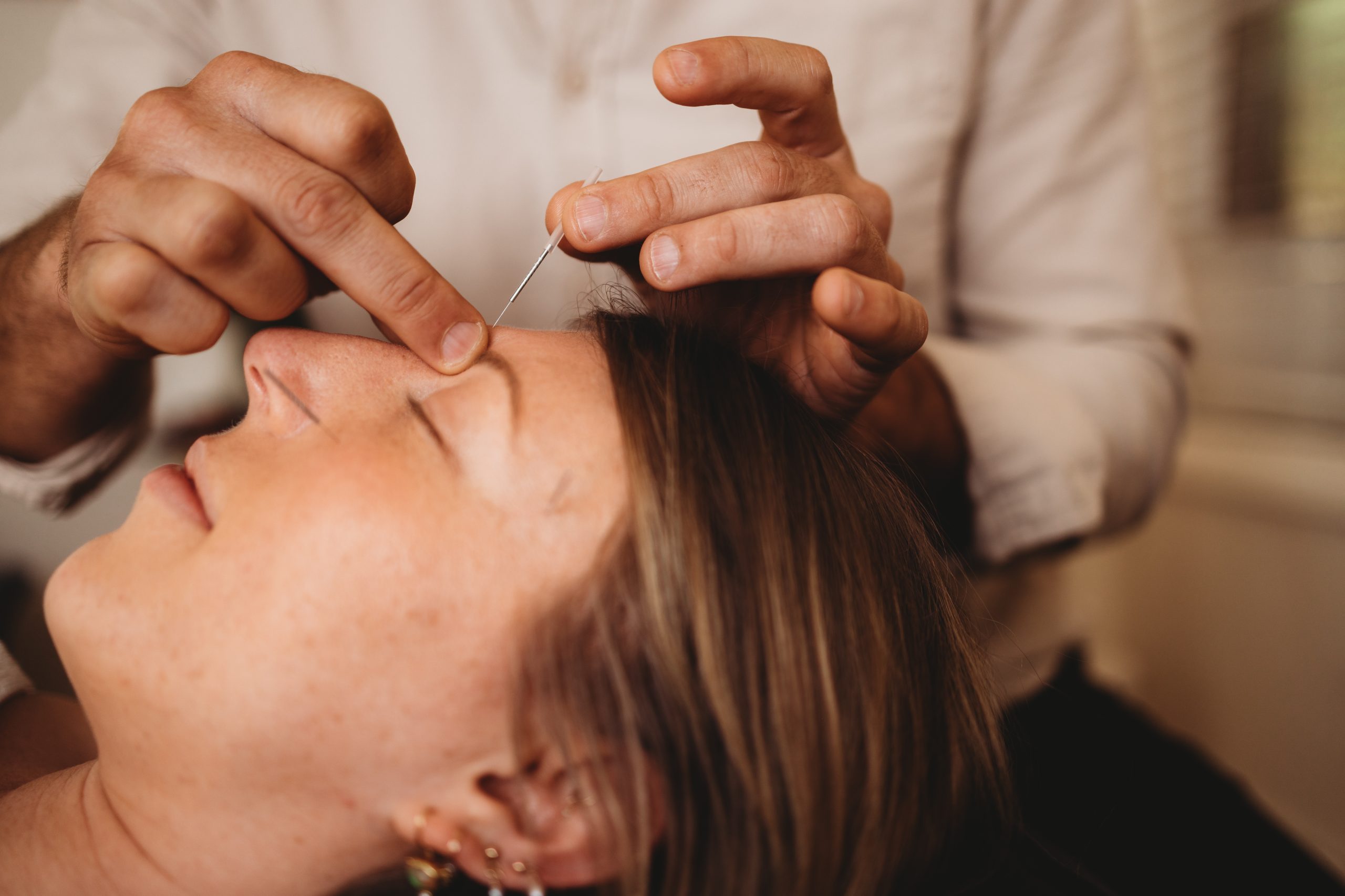 Dr. Truth Robinson performing acupuncture treatment Byron Bay