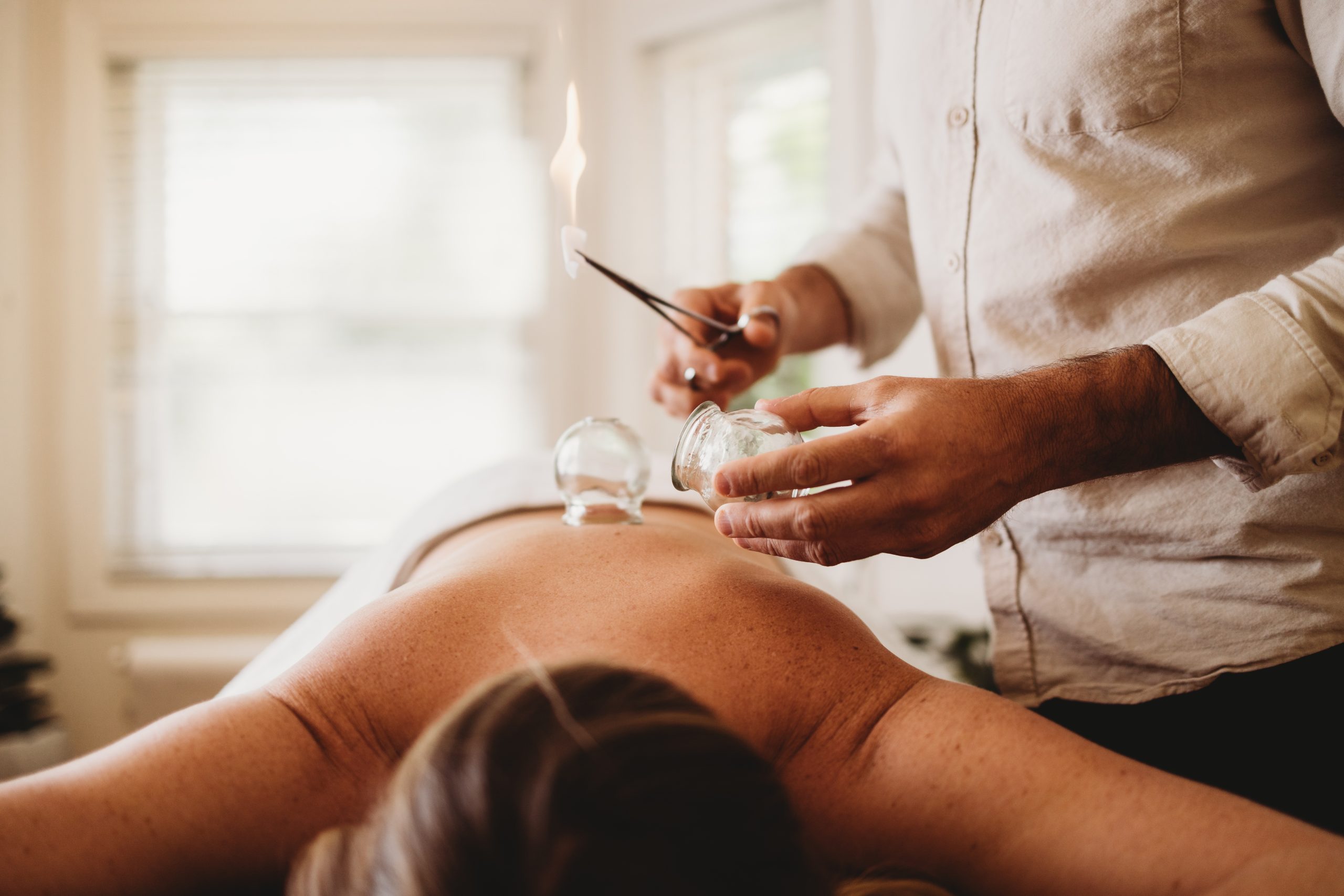 Dr. Truth Robinson performing acupuncture treatment at Ascend Acupuncture Byron Bay