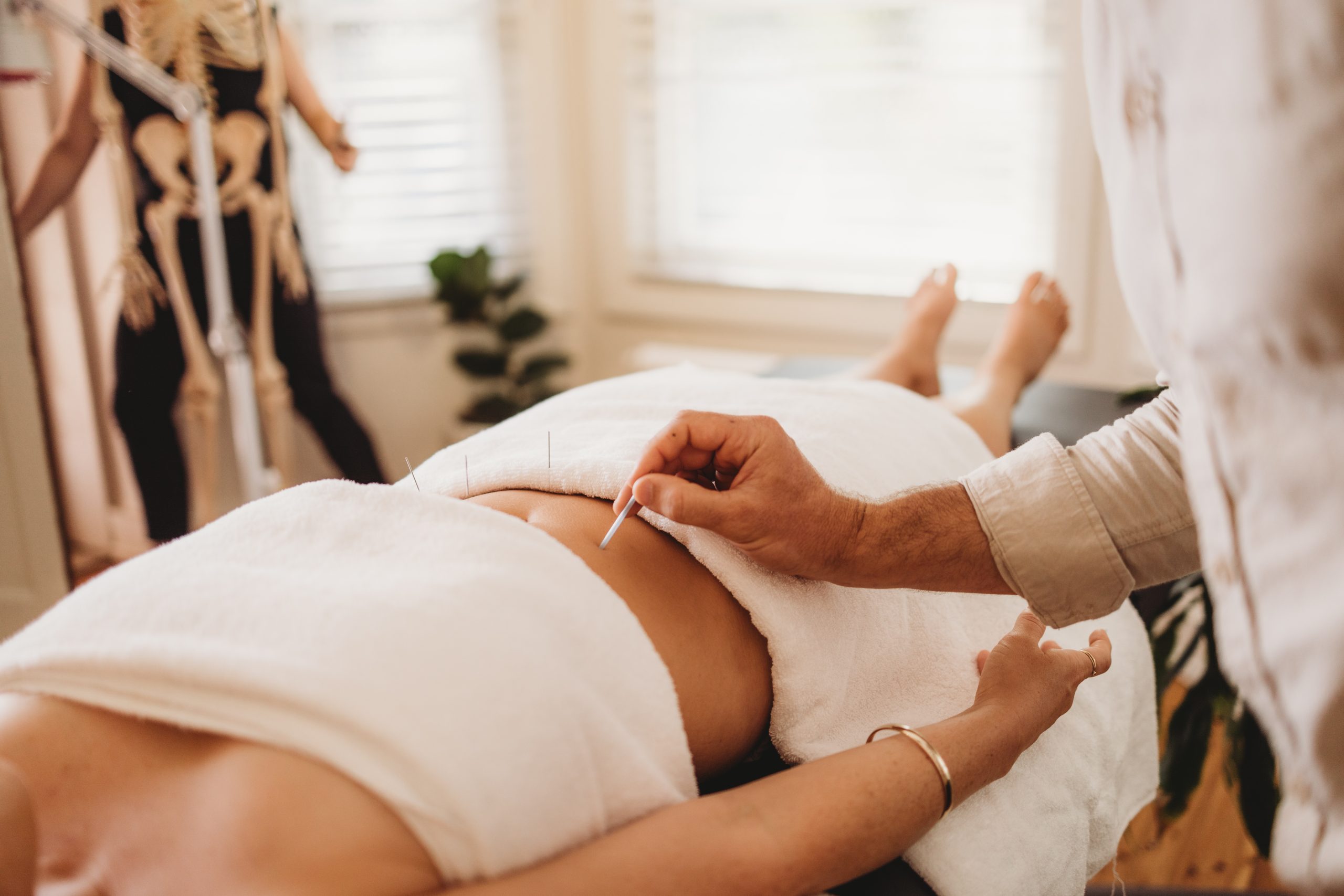 Dr. Truth Robinson performing acupuncture